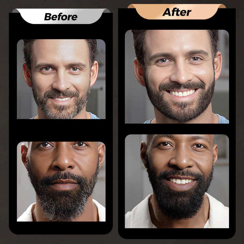 BeardPen Pro™ – 4-Spitzen Bart-Korrekturstift | 1+2 GRATIS - Image 3