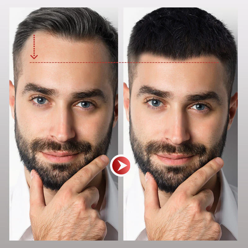 InvisiHair™ Männer-Stirnhaar-Toupet Soforthilfe - Image 4