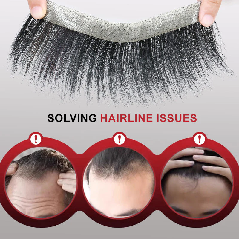 InvisiHair™ Männer-Stirnhaar-Toupet Soforthilfe - Image 5