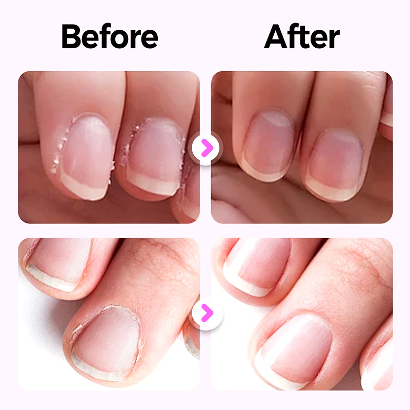 NailÉlixir – Duftender Nagelpflege Stift | 1+2 GRATIS - Image 11