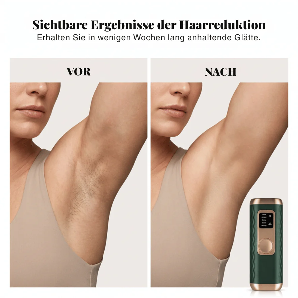 LuminaLuxe — Kühlendes IPL-Gerät | 50% RABATT - Image 3