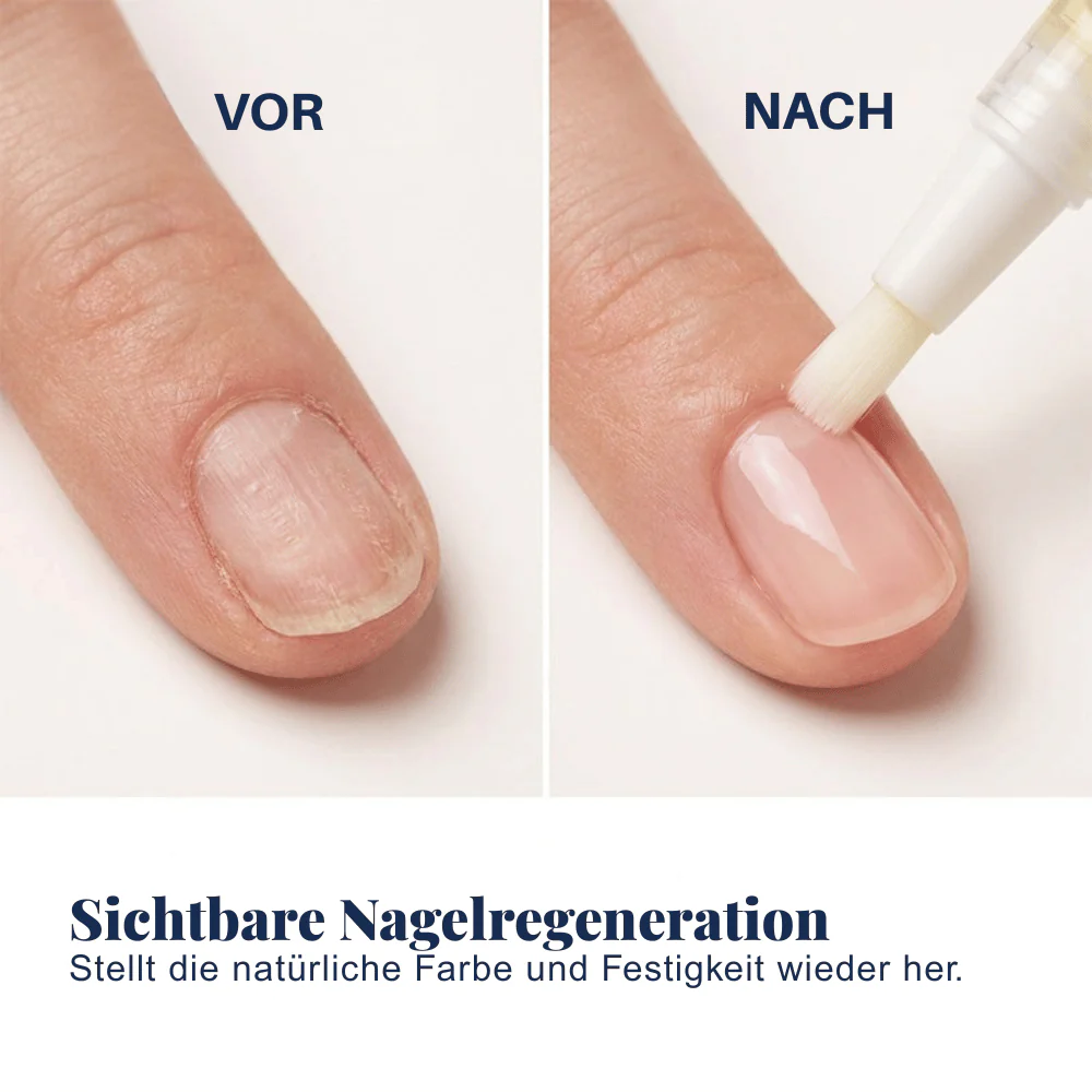 Nail Recovery — Nagelpflege-Stift-Set | 1+1 GRATIS - Image 4