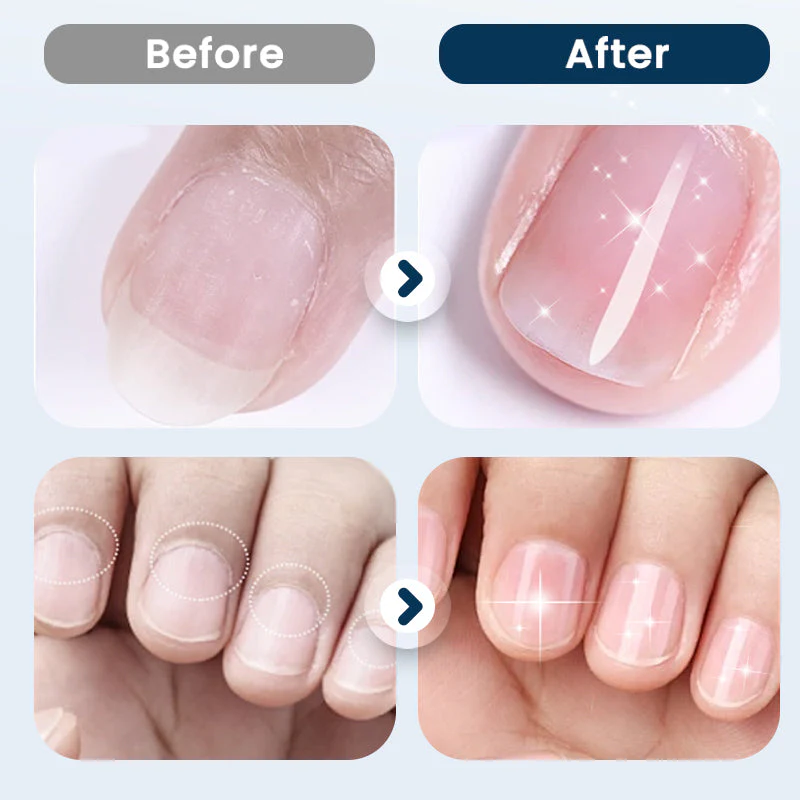 NailRevive – Stärkendes Nagelspray | 1+1 GRATIS - Image 8