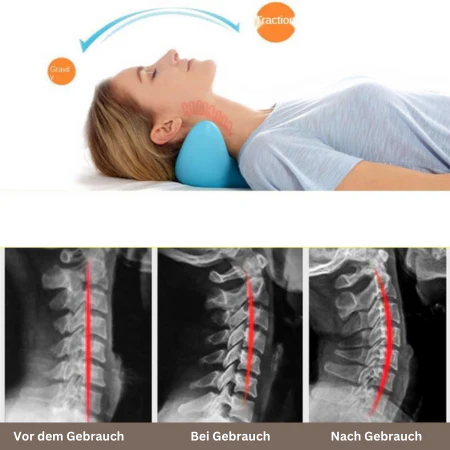 RelaxoFlex™ - Entspannen Sie Ihren Nacken | 50% RABATT - Image 4
