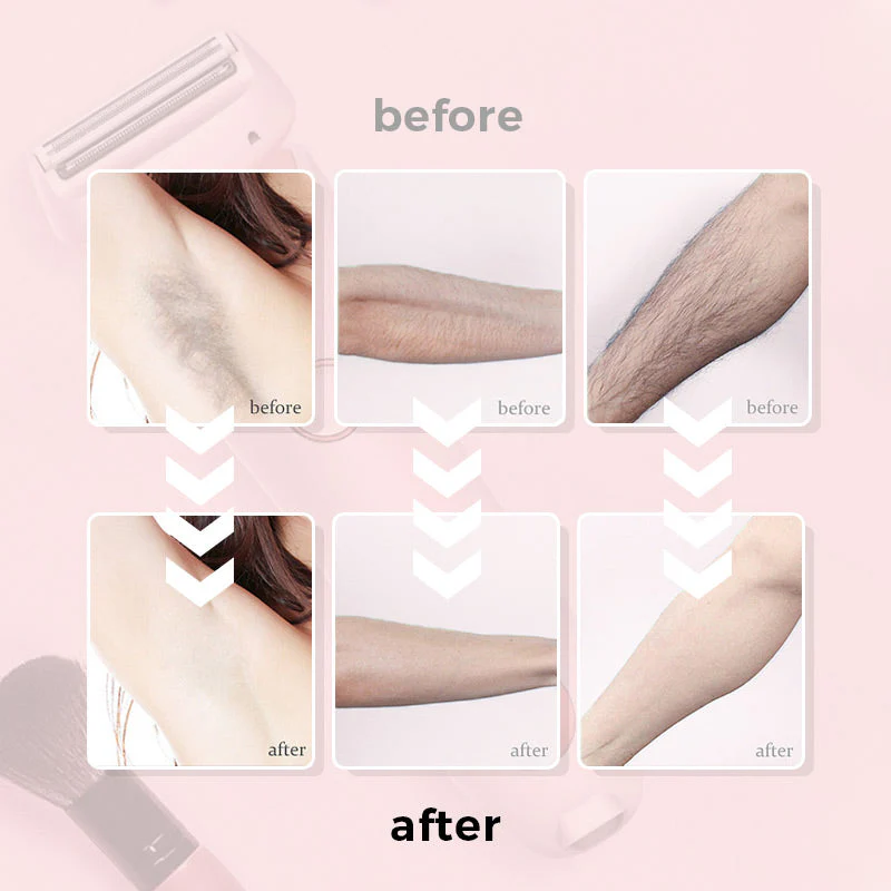 SilkGlide Pro - Multifunktionaler Rasierer für Frauen - Image 10