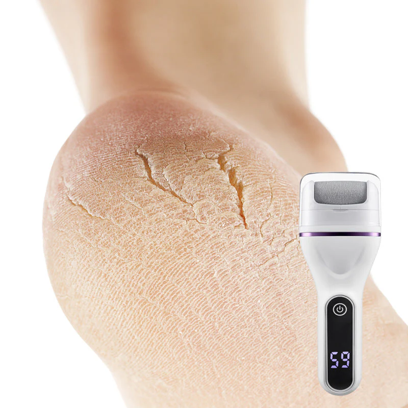 SoftStep™ – Glatte Füße in Minuten | 50% RABATT - Image 9