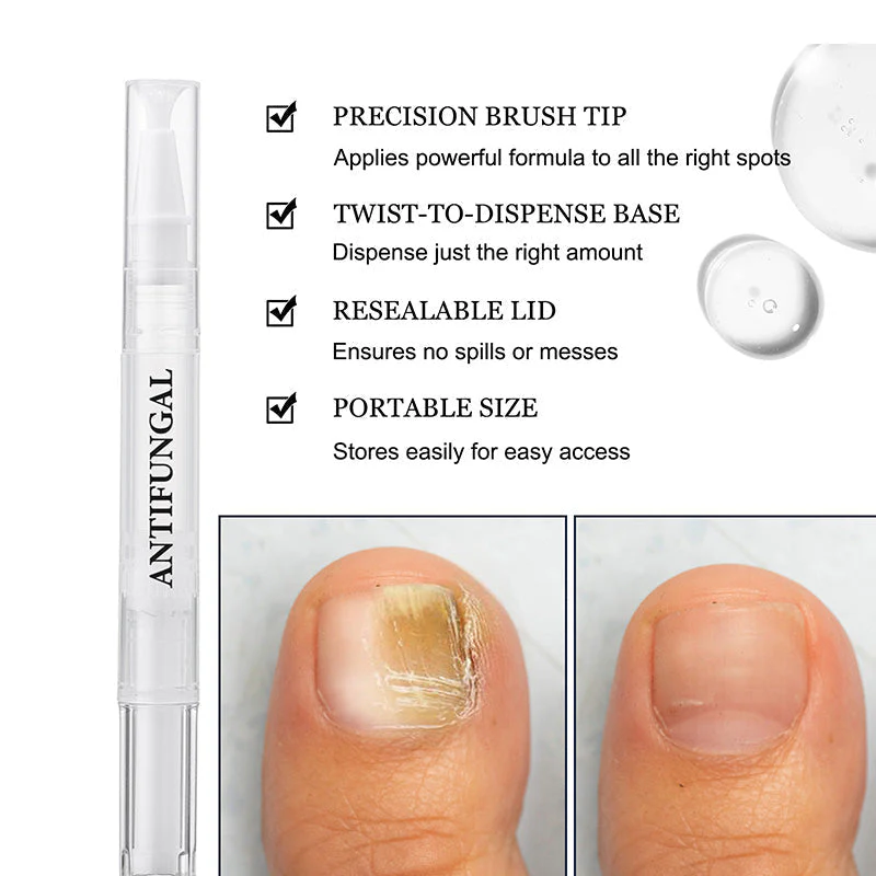 StrongNail – Präzise Nagelpflege | 1+1 GRATIS - Image 10