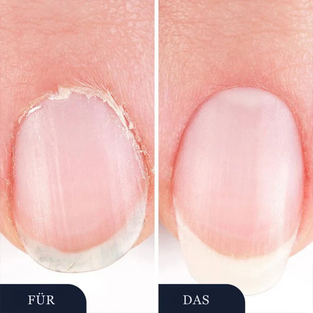 StrongNail – Präzise Nagelpflege | 1+1 GRATIS - Image 5
